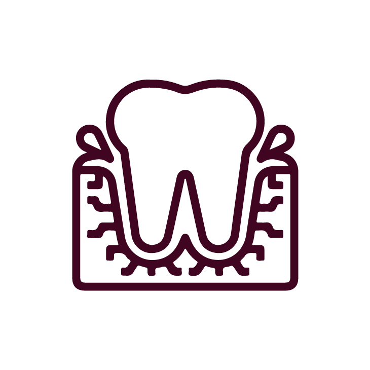 Periodoncia
